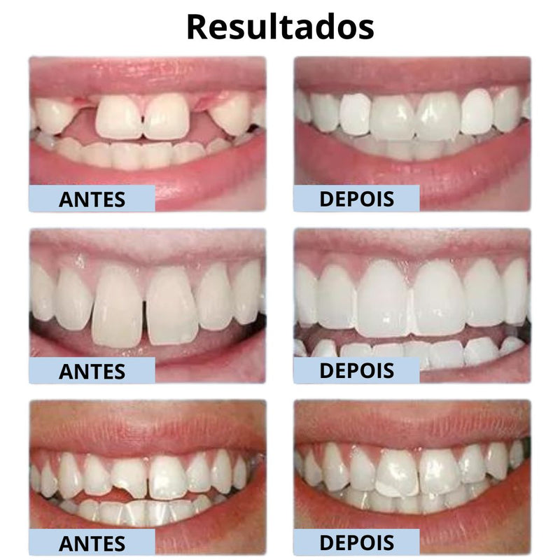 Molde para Dentes - Sorriso Fix